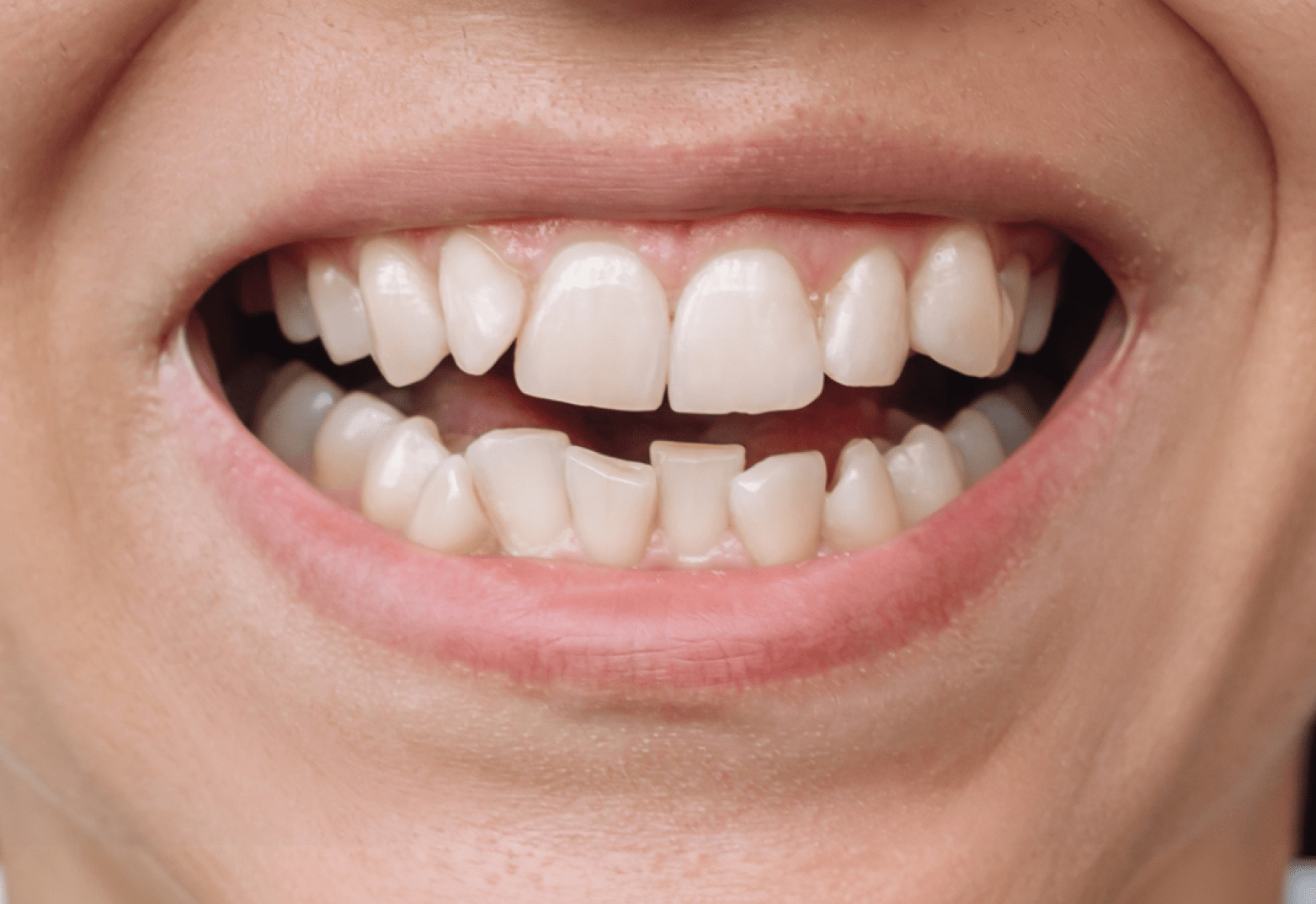 Frame 2147225412 Frame 2147225412